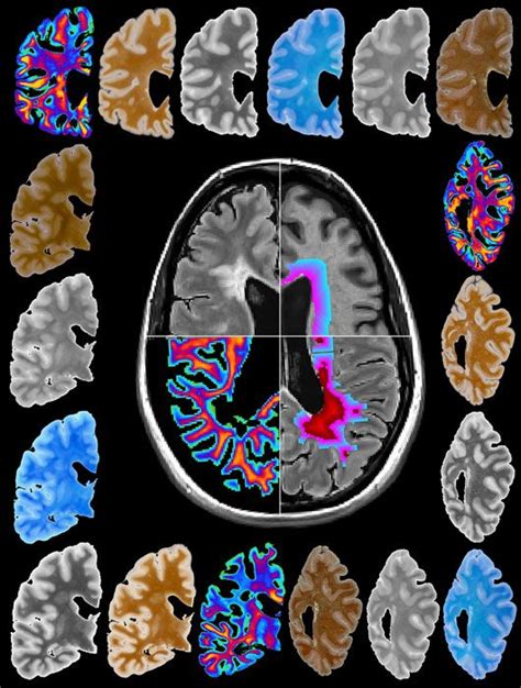 prada brain|HUMAN BRAINS: PRESERVING THE BRAIN FORUM ON .